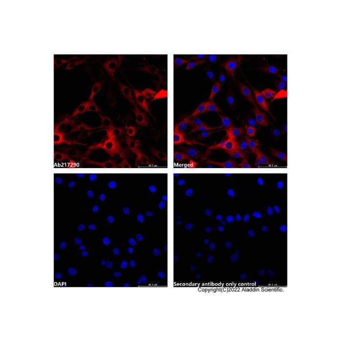 Goat Anti-Rabbit IgG H&L (AF660) -    by Aladdin Scientific