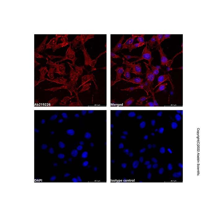 alpha-Smooth Muscle Actin Mouse mAb (TRITC) -    by Aladdin Scientific