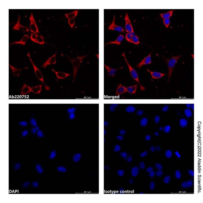 Profilin 1 Mouse mAb (Biotin) -    by Aladdin Scientific