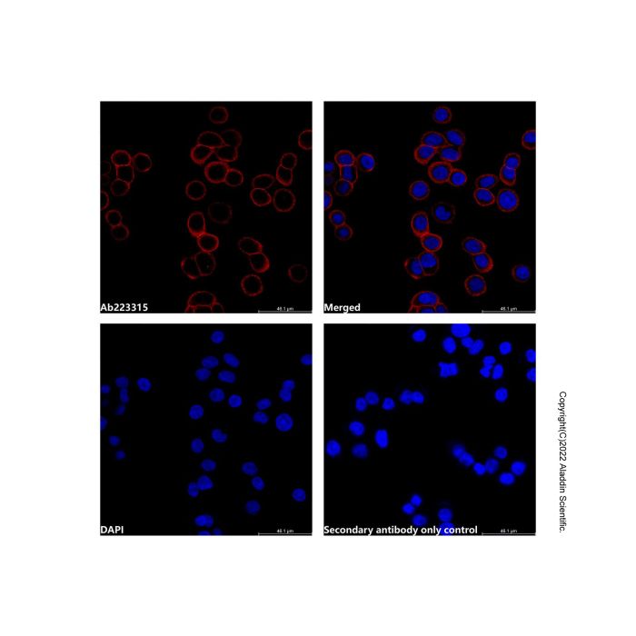 Goat Anti-Rabbit IgG H&L (AF555) -    by Aladdin Scientific