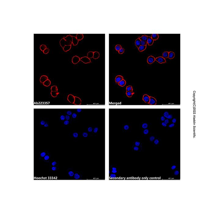 Goat Anti-Mouse IgG H&L (AF555) -    by Aladdin Scientific