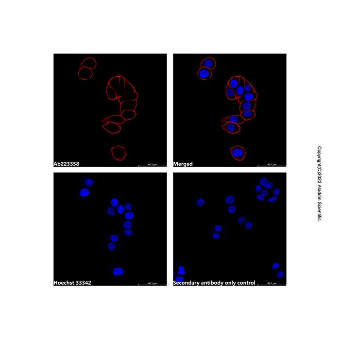 Goat Anti-Mouse IgG H&L (AF568) -    by Aladdin Scientific