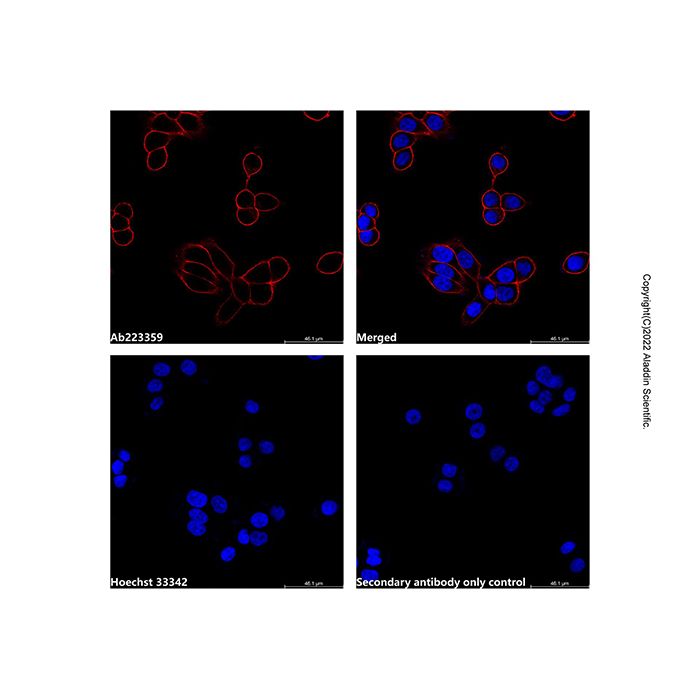 Goat Anti-Mouse IgG H&L (AF594) -    by Aladdin Scientific