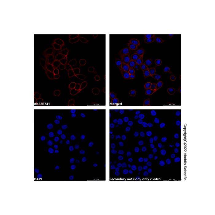 Mouse Anti-Human IgG (AF647) -    by Aladdin Scientific