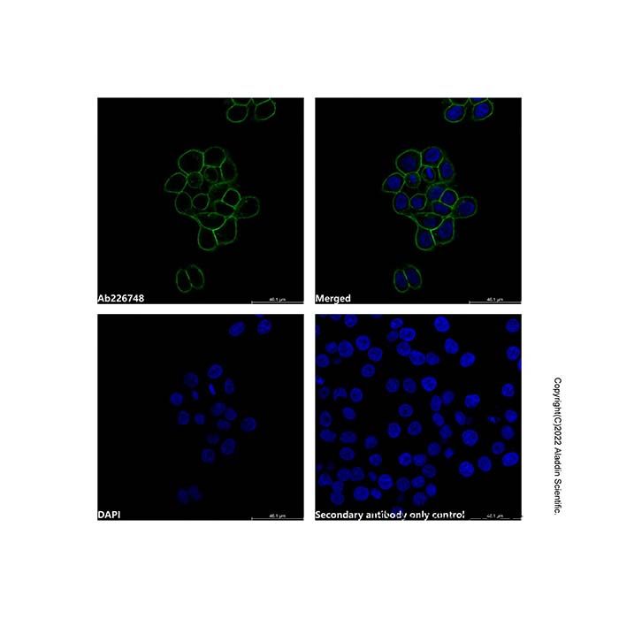 Mouse Anti-Human IgG (FITC) -    by Aladdin Scientific