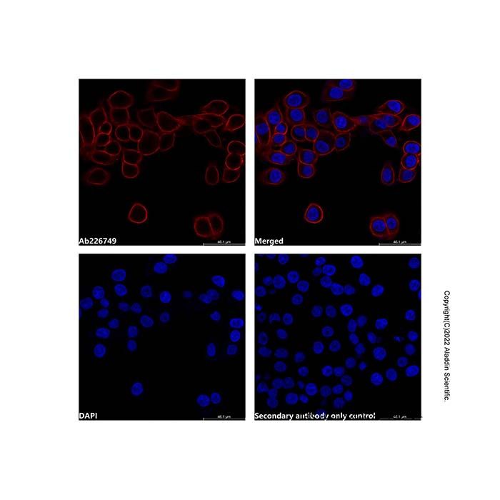 Mouse Anti-Human IgG (PE) -    by Aladdin Scientific