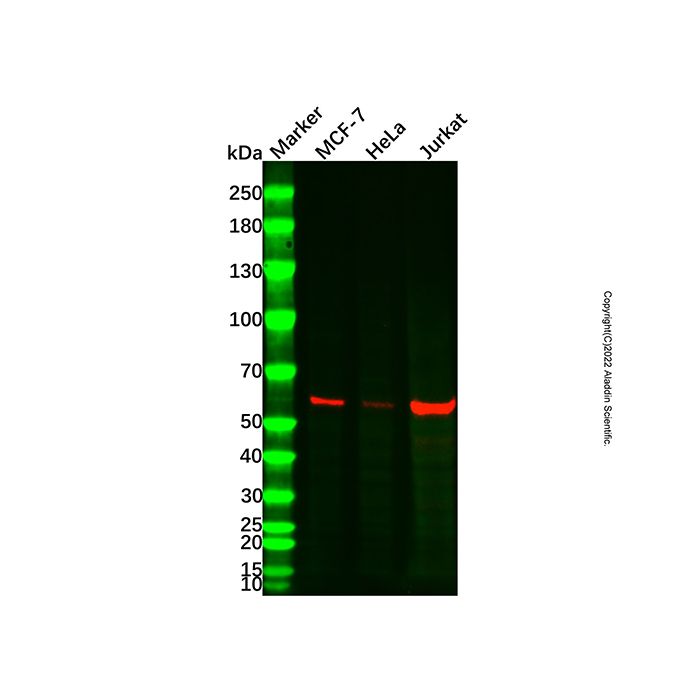 YY1 Mouse mAb -    by Aladdin Scientific