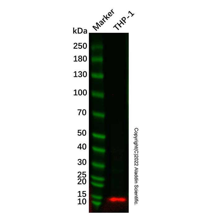 Recombinant Natriuretic peptides A Antibody -    Ab307897 by Aladdin Scientific