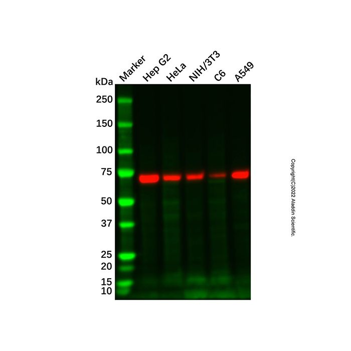 Donkey Anti-Rabbit IgG H&L (HRP) -    Ab310102 by Aladdin Scientific