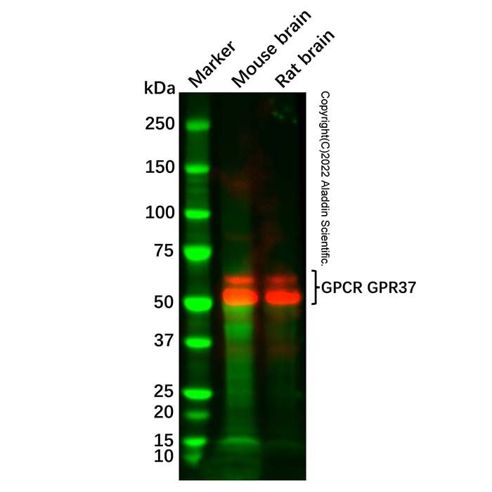 Recombinant GPCR GPR37 Antibody -    by Aladdin Scientific
