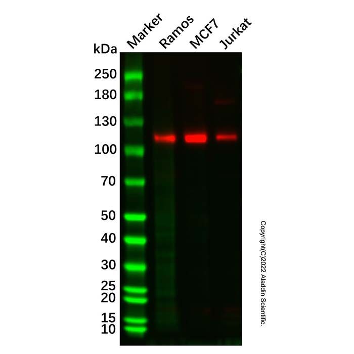 Recombinant PSD93 Antibody  -    Ab327984 by Aladdin Scientific