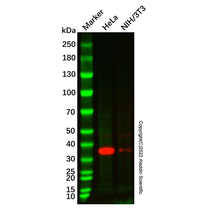 Recombinant EMAP II/AIMP1 Antibody  -    Ab331299 by Aladdin Scientific