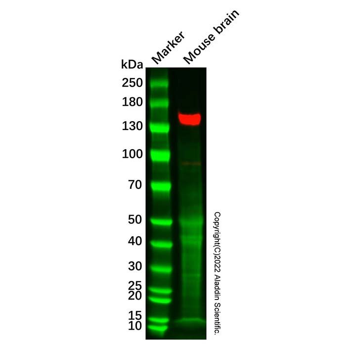 Recombinant SynGAP Antibody  -    Ab331309 by Aladdin Scientific
