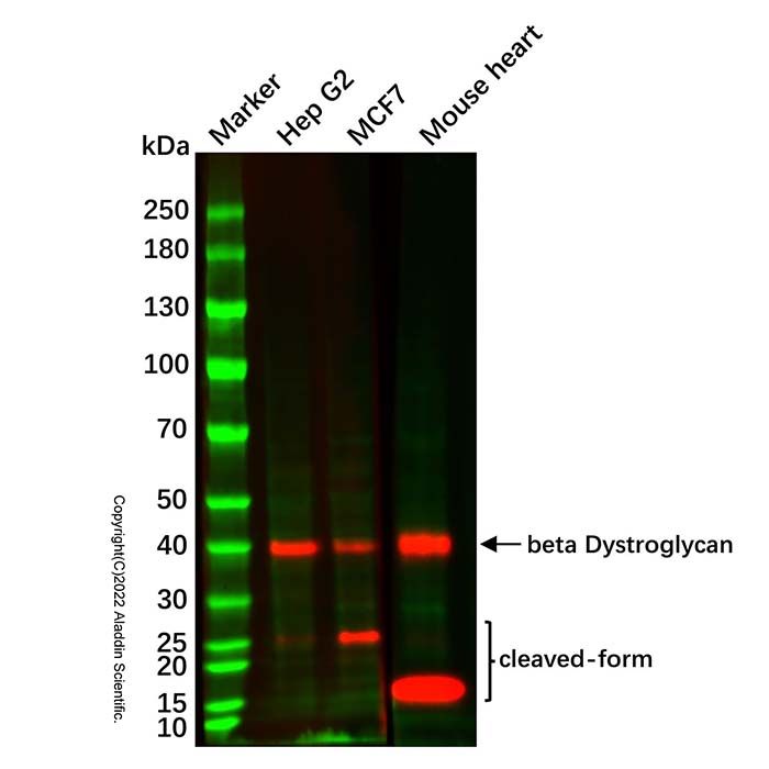 Recombinant beta Dystroglycan Antibody -    Ab336566 by Aladdin Scientific
