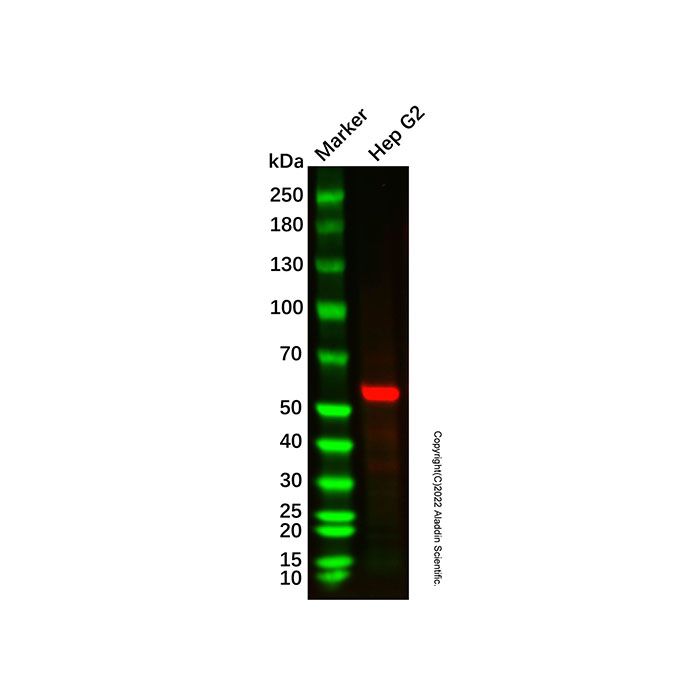 Recombinant Protein C Antibody -    Ab336922 by Aladdin Scientific