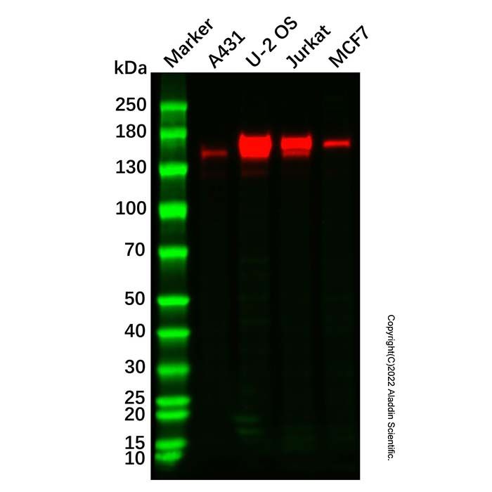 Recombinant NCAPD2 Antibody -    Ab336932 by Aladdin Scientific