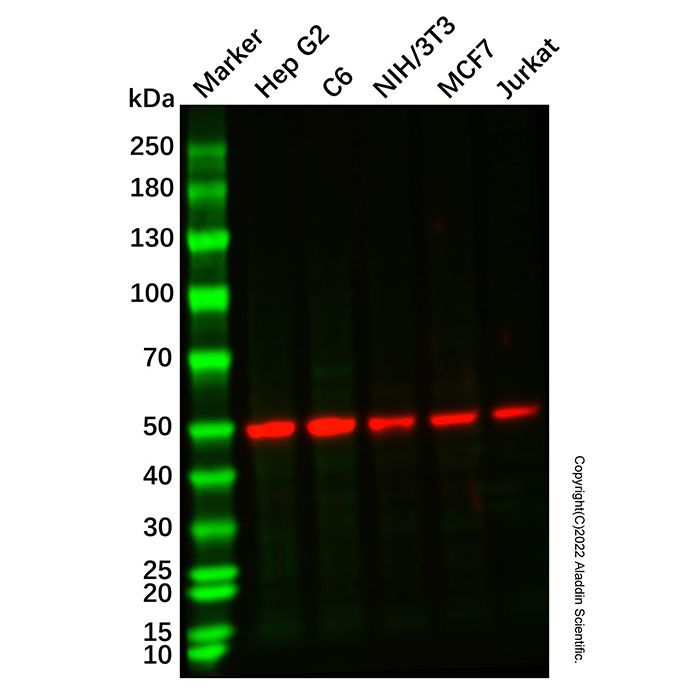 Recombinant EGR2 Antibody -    Ab336936 by Aladdin Scientific