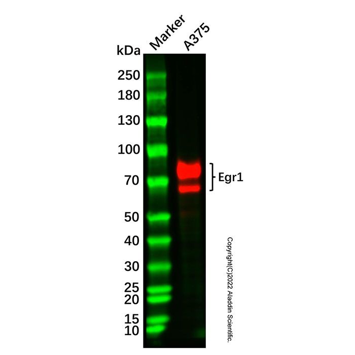 Recombinant Egr1 Antibody -    Ab336938 by Aladdin Scientific