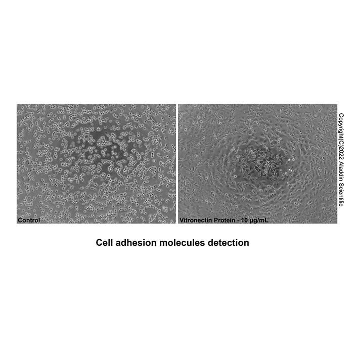 Recombinant Human Vitronectin Protein -    by Aladdin Scientific