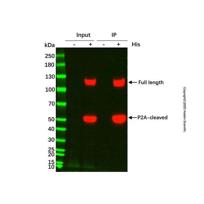 UltraBio™ His-tag Purification Resin -    by Aladdin Scientific