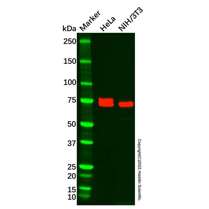 Carcino Embryonic Antigen CEA Antibody -   ≥95% by Aladdin Scientific