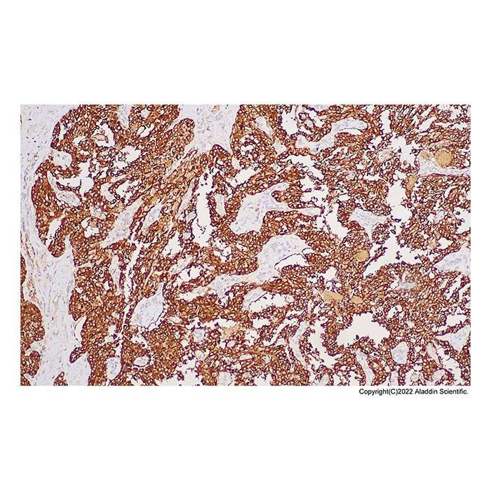 Recombinant Calcitonin Antibody -    by Aladdin Scientific