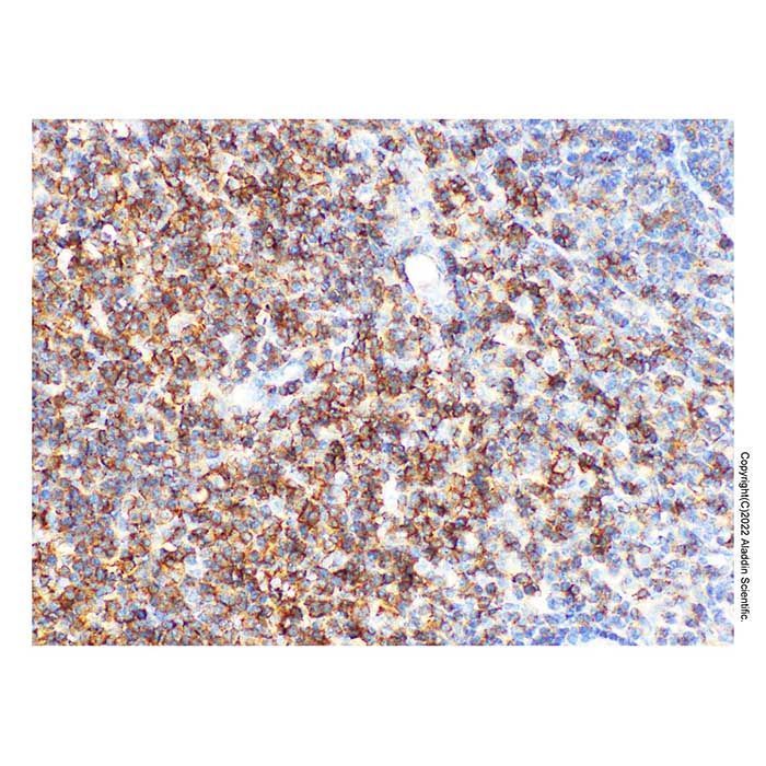 CD2 Mouse mAb -    by Aladdin Scientific