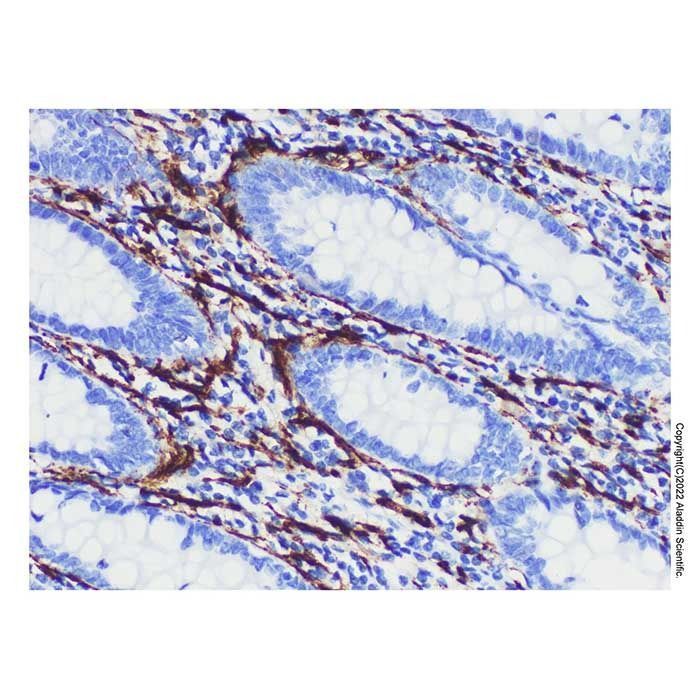 NCAM1 Mouse mAb -    by Aladdin Scientific