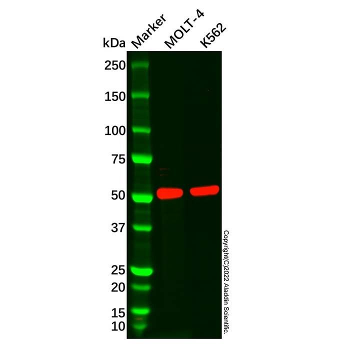 CD1a Mouse mAb - by Aladdin Scientific