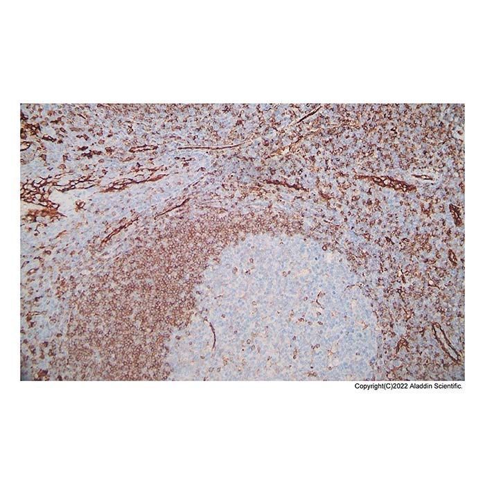 Recombinant CD31 Antibody -    by Aladdin Scientific