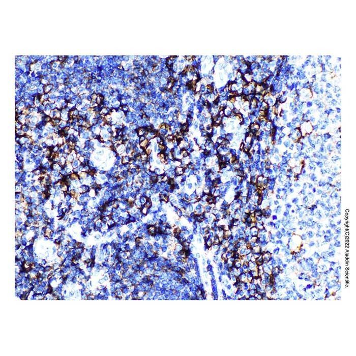 CD44 Mouse mAb - by Aladdin Scientific