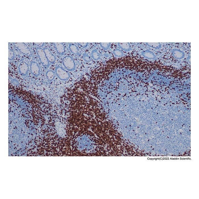 Recombinant CD3 Antibody -    by Aladdin Scientific