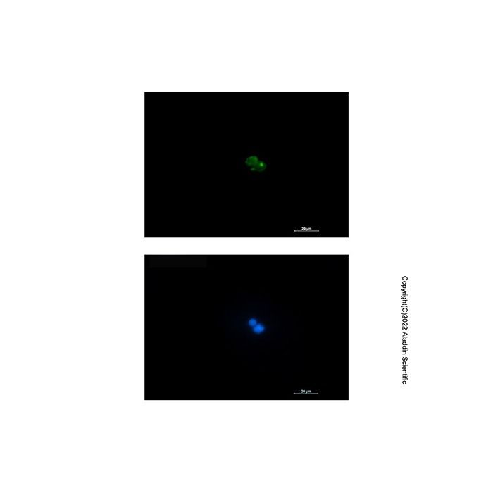 Recombinant CD7 Antibody -    by Aladdin Scientific