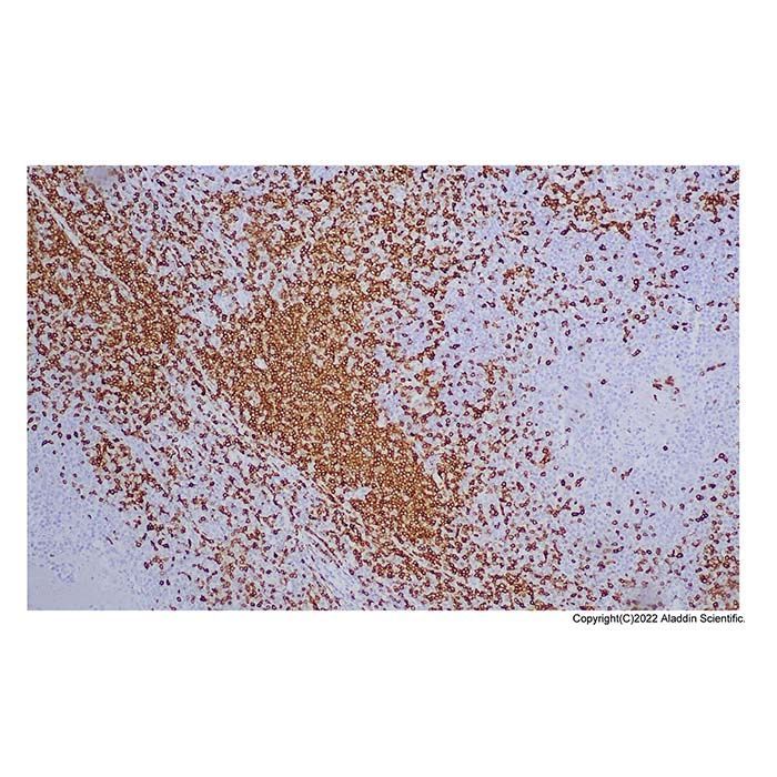 Recombinant CD7 Antibody -    by Aladdin Scientific