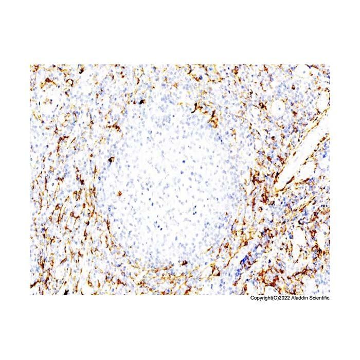 Recombinant CD13 Antibody -    by Aladdin Scientific