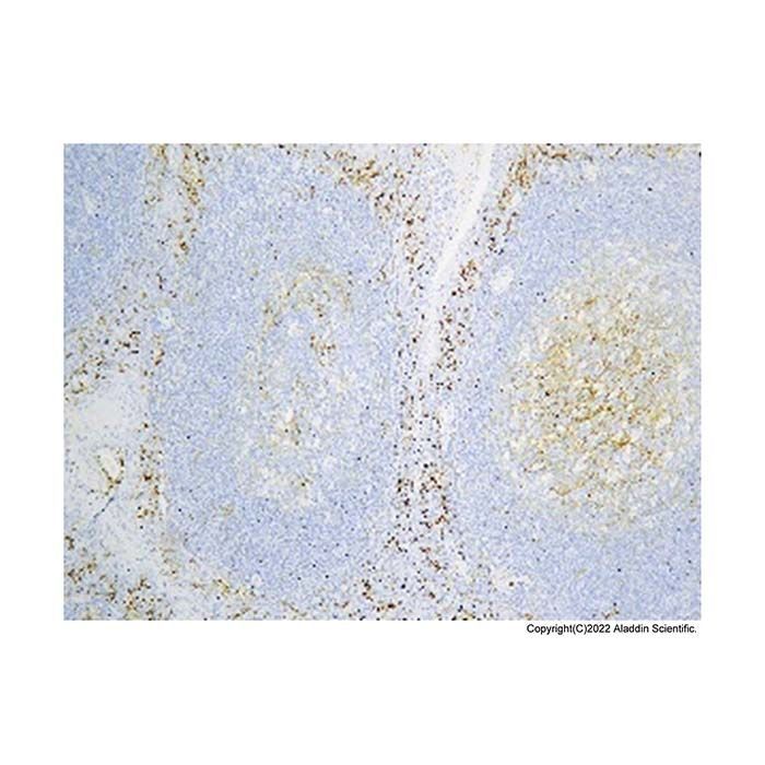 Recombinant CD14 Antibody -    by Aladdin Scientific