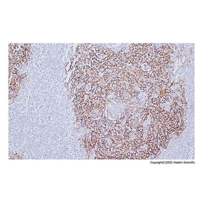 Recombinant CD21 Antibody -    by Aladdin Scientific