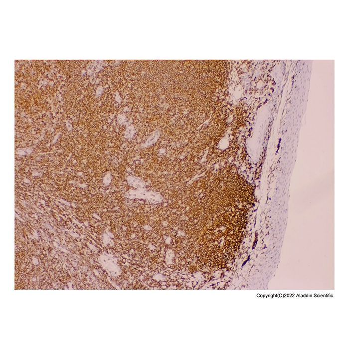 Recombinant CD45 Antibody -    by Aladdin Scientific