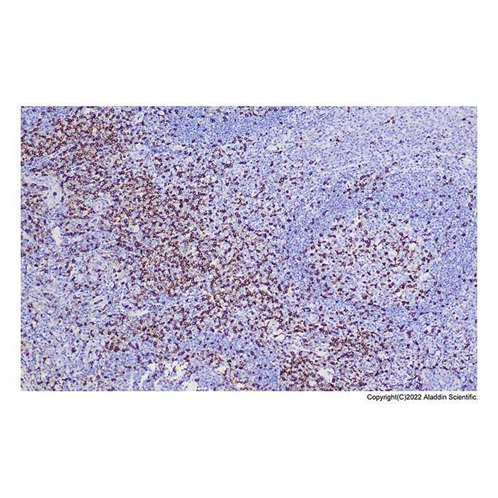 Recombinant CD45RO Antibody -    by Aladdin Scientific