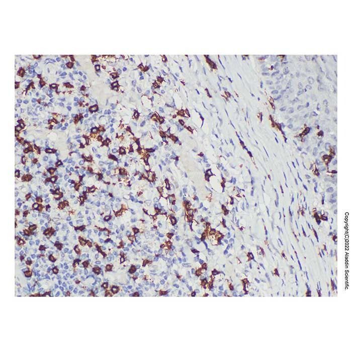 CD8 alpha Mouse mAb -    by Aladdin Scientific