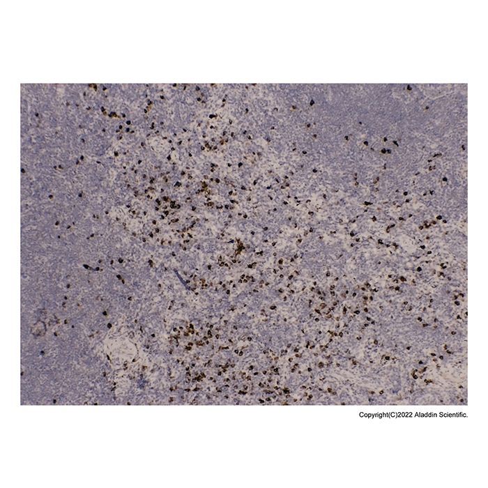 IgA Antibody -    by Aladdin Scientific
