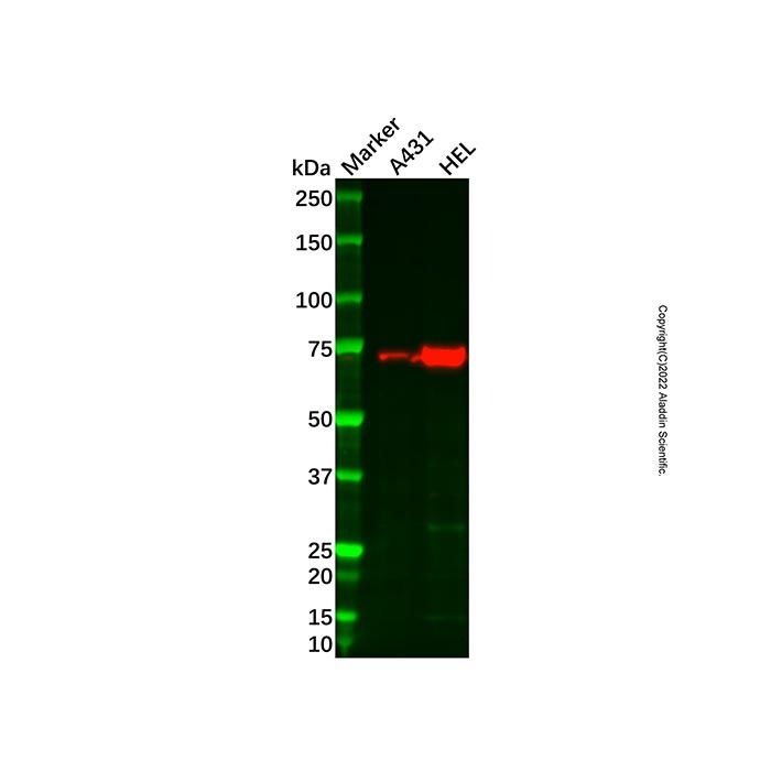 Recombinant 12 Lipoxygenase/ALOX12 Antibody -    by Aladdin Scientific