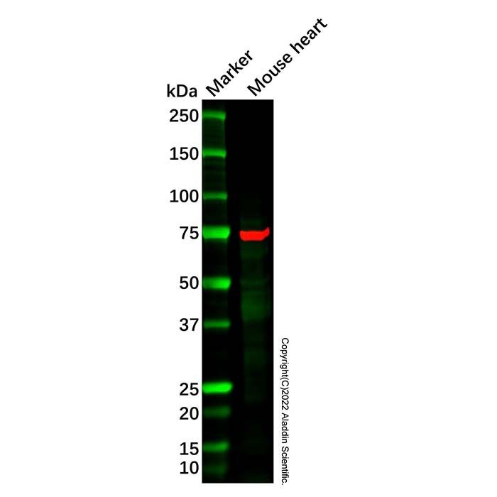 15 Lipoxygenase 1 Antibody -    by Aladdin Scientific