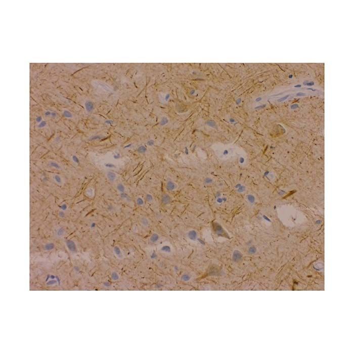 Recombinant Neurofilament-M Antibody - by Aladdin Scientific