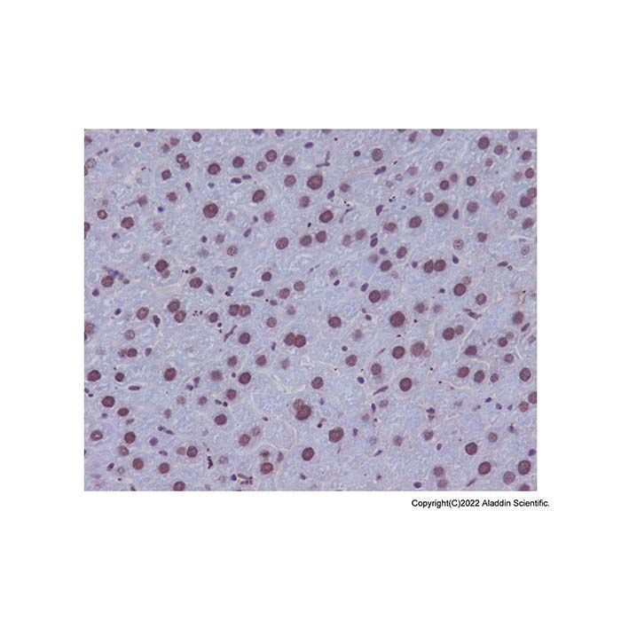 53BP1 Antibody -    by Aladdin Scientific