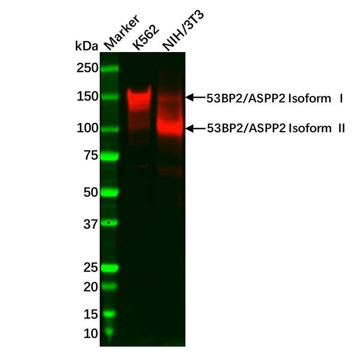 Recombinant 53BP2/ASPP2 Antibody -    by Aladdin Scientific