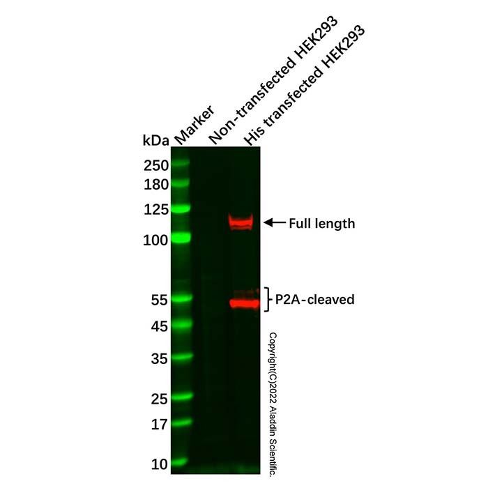 Recombinant His tag Antibody -    by Aladdin Scientific