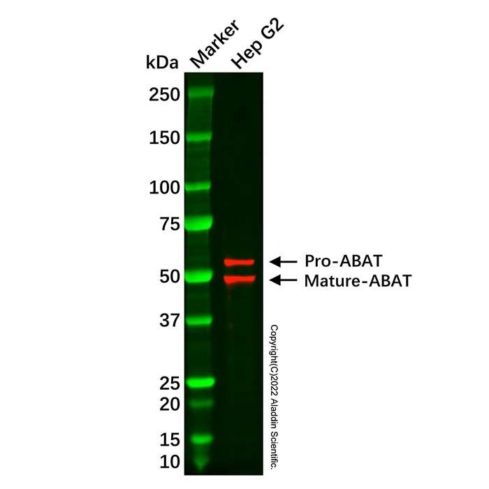 Recombinant ABAT/GABA-T Antibody -    by Aladdin Scientific