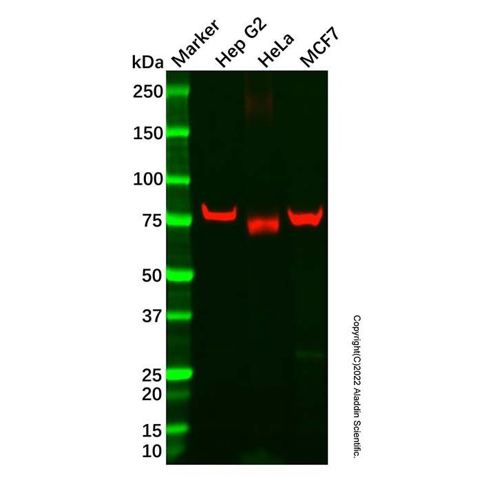 Recombinant ABCD1/ALD Antibody -    by Aladdin Scientific