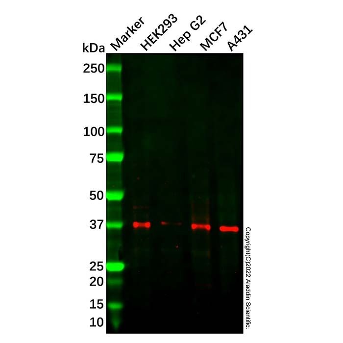 Recombinant ABO Antibody -    by Aladdin Scientific